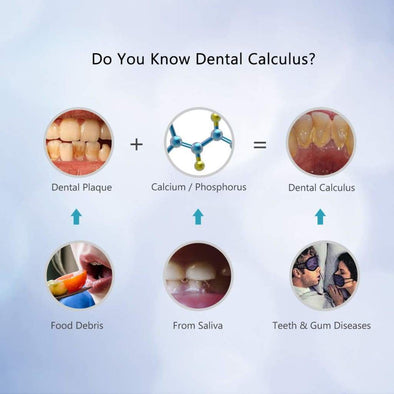 Do You Know About Dental Calculus?
